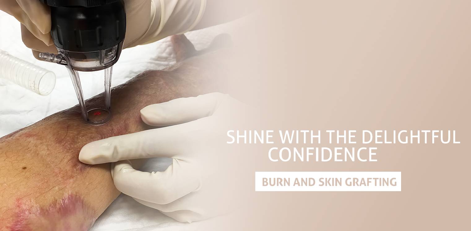 Burn Skin Grafting Treatment