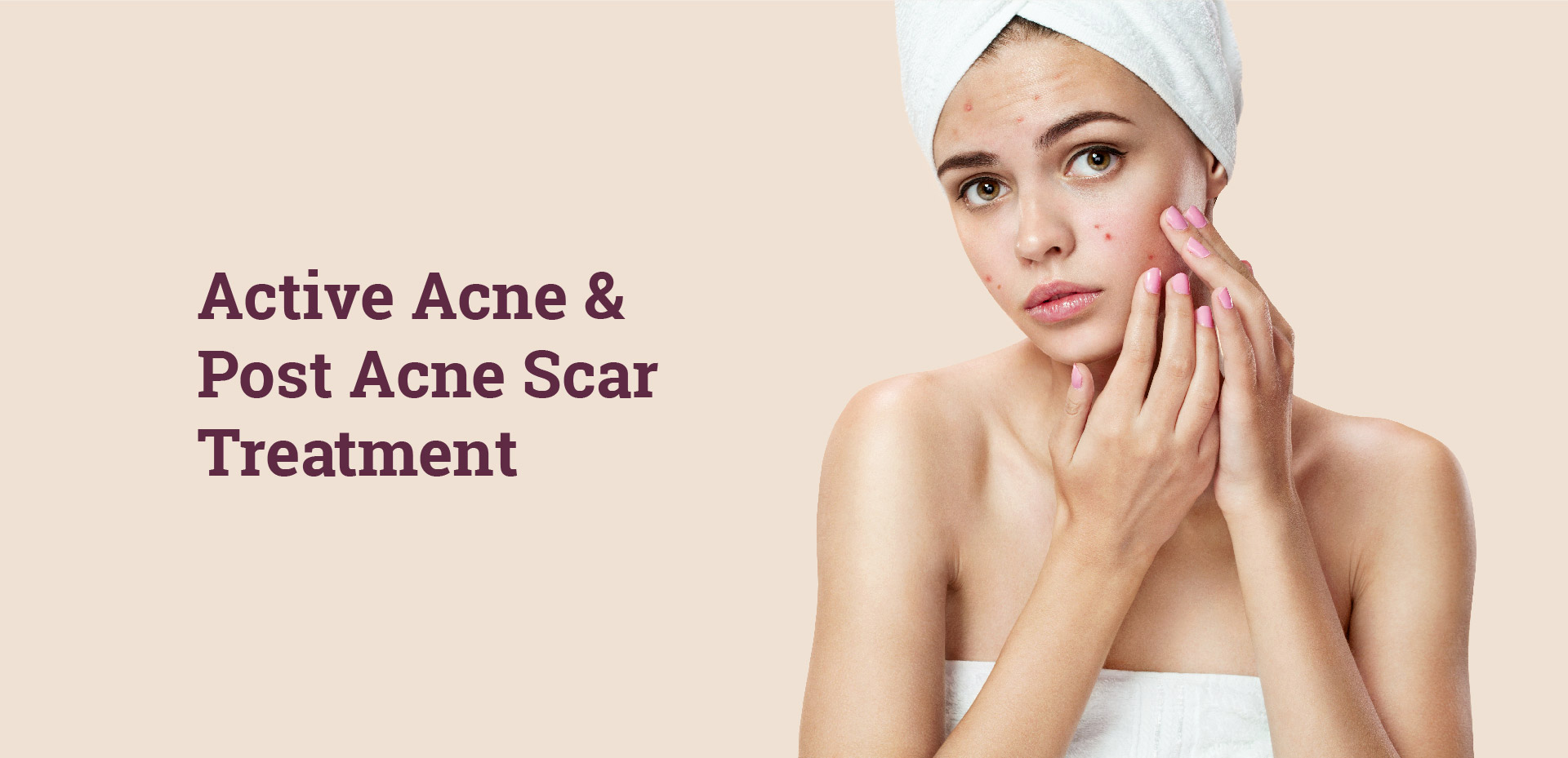 Active Acne & Acne Scar Treatment