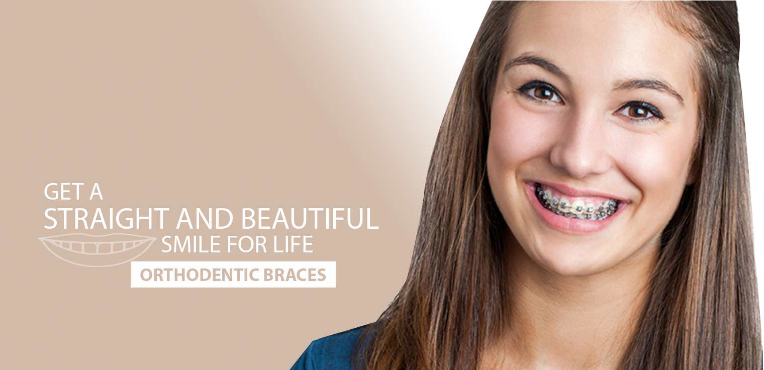 Orthodontic Braces Treatment