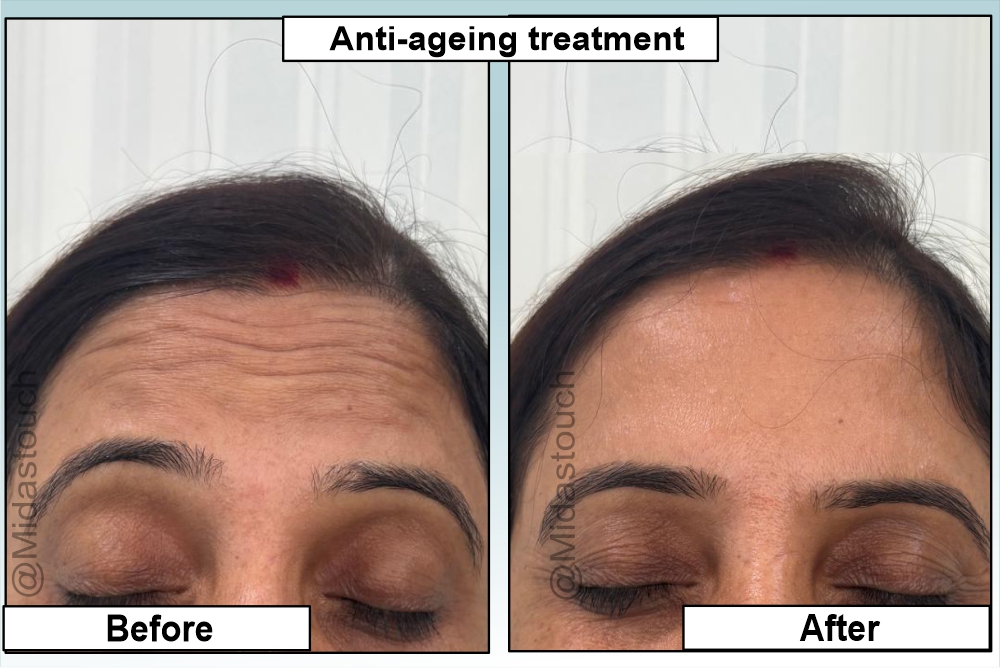 Skin and Hair Care Treatment