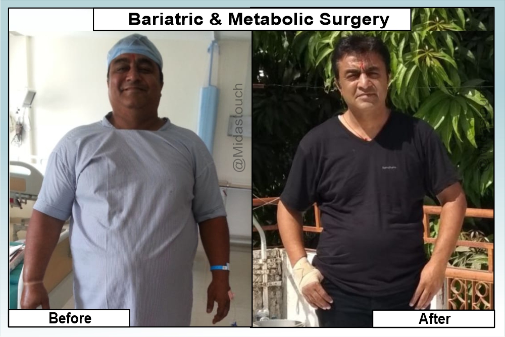 Bariatric & Metabolic Surgery