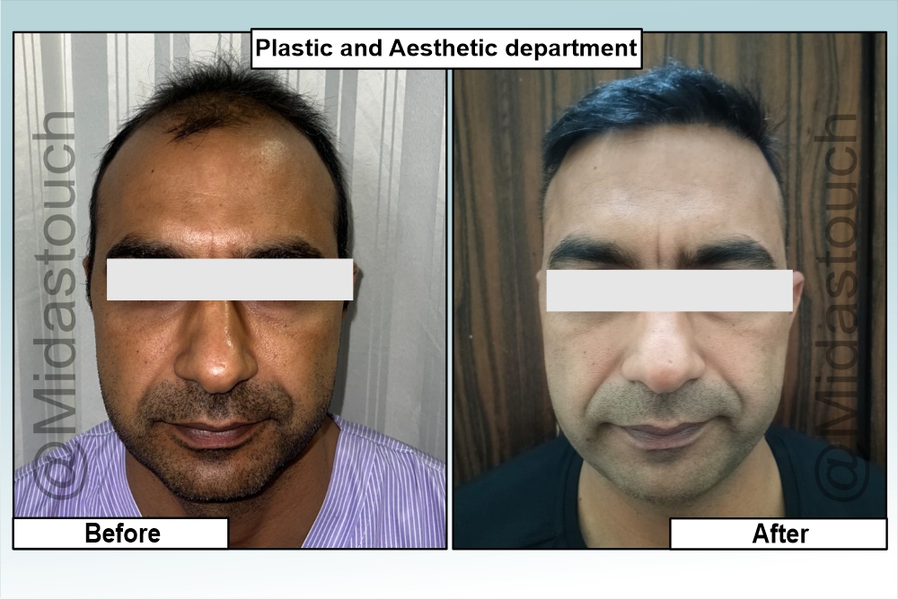 Plastic surgery pictures