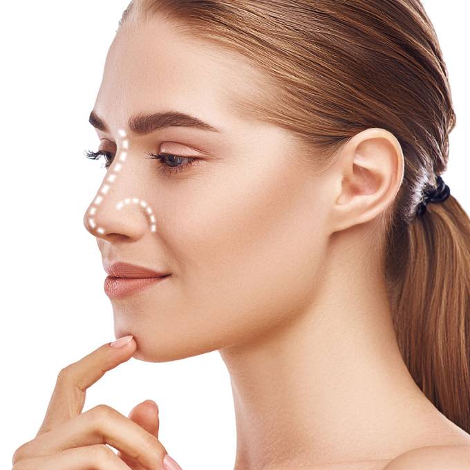 Benefits of Nose Surgery
