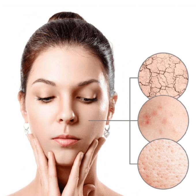 Why Skin Polishing Treatment