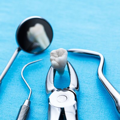 Tooth Extraction Procedures