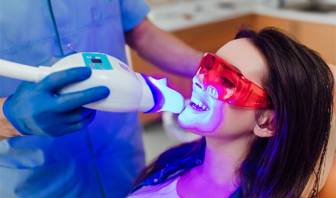 How Laser Teeth Whitening Is Done?